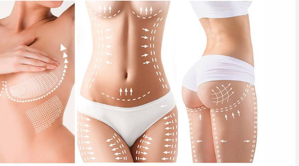 Experience Total Renewal with Tummy Tuck in Miami post thumbnail image