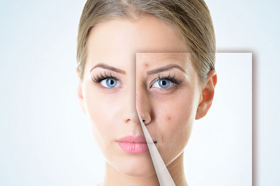 Collagen Injection Specialists Nearby: Your Beauty Upgrade post thumbnail image