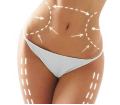 The Safety Measures of Undergoing a Tummy Tuck in Miami post thumbnail image